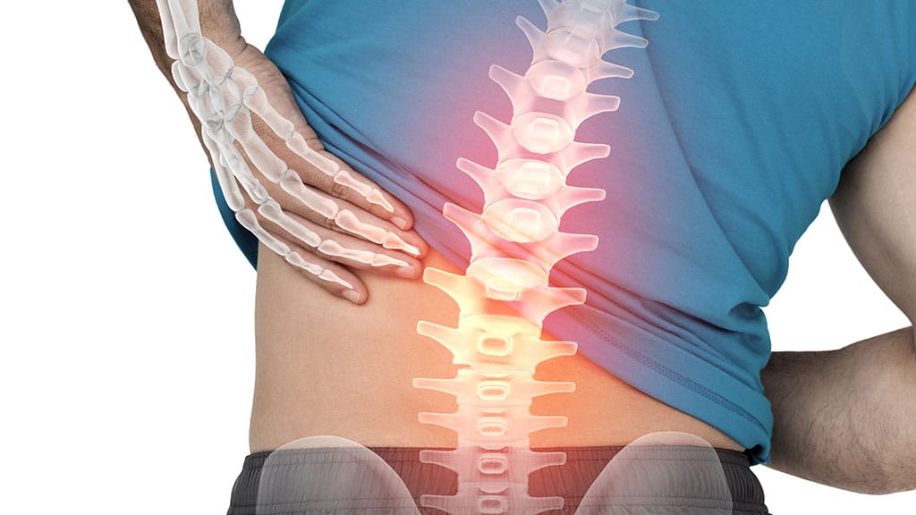 Low back pain - Vertebral column